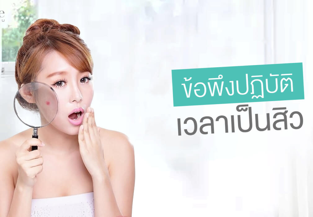 ข้อพึงปฏิบัติเวลาเป็นสิว ข้อพึงปฏิบัติเวลาเป็นสิว